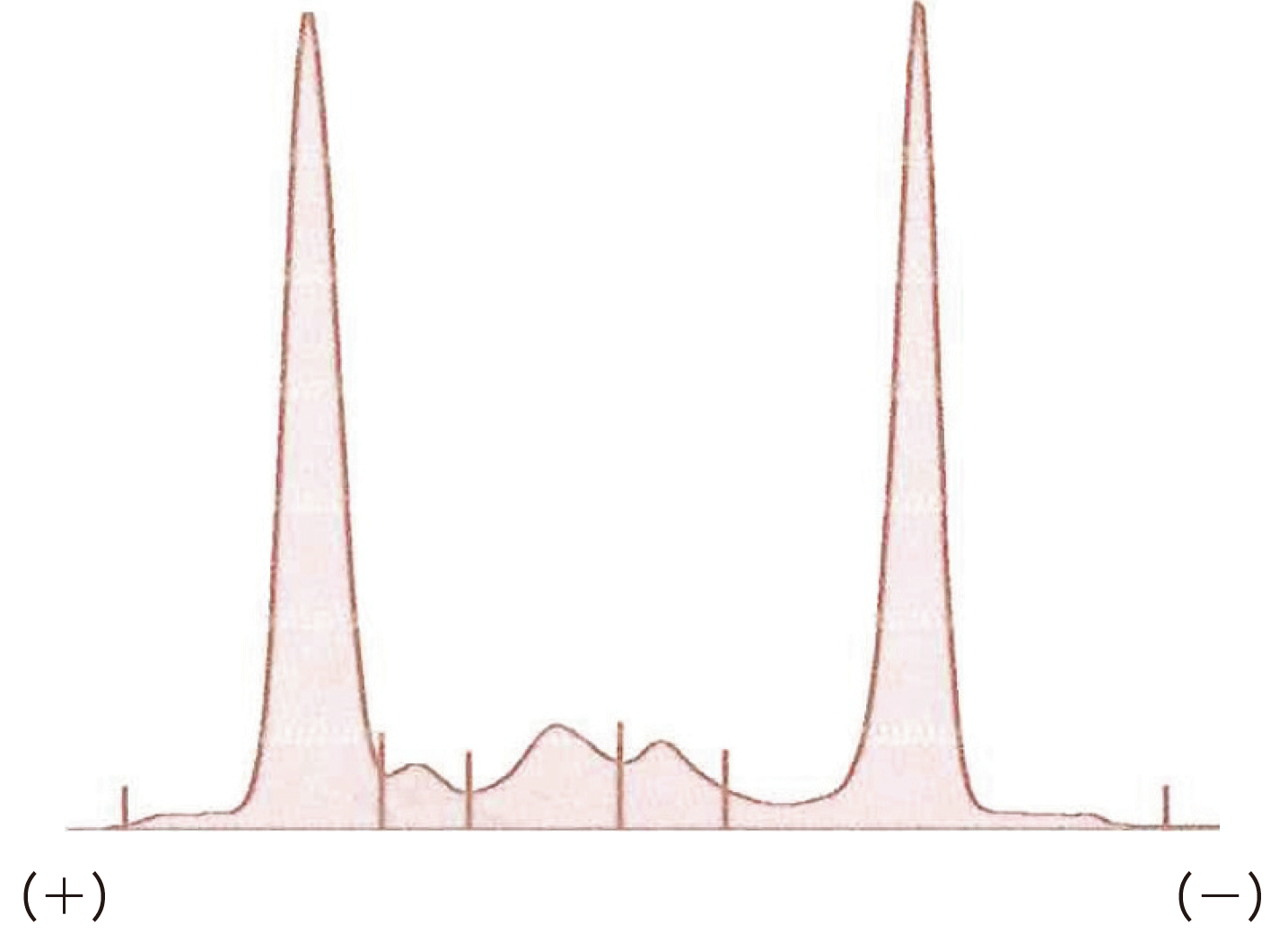血清タンパク質電気泳動を理解する