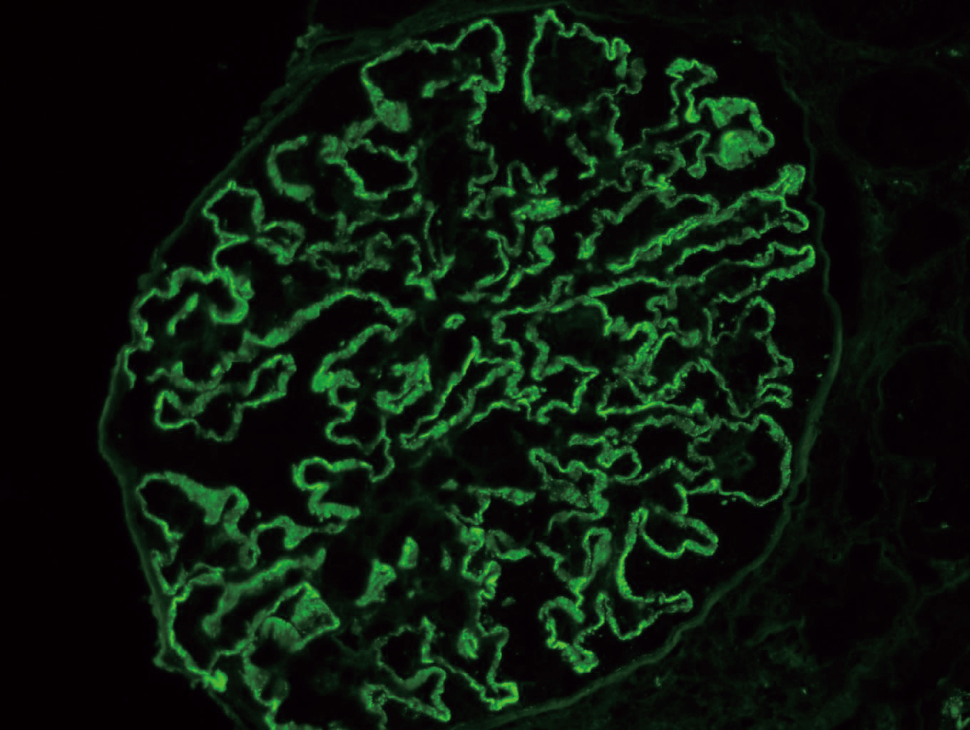 問題「腎組織の未固定凍結切片を用い … 」 臨床検査技師国試【過去問演習】 | BootoPass