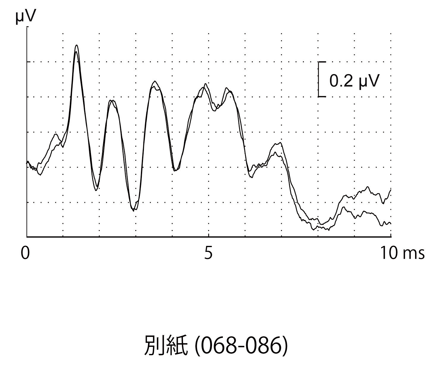 問題「誘発電位(別冊No.5)を別 … 」 臨床検査技師国試【過去問演習】 BootoPass
